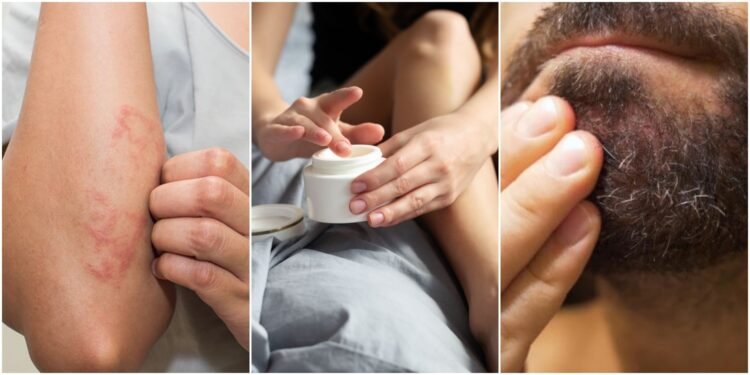 Hassas Ciltler İçin En Etkili Bakım Ürünleri