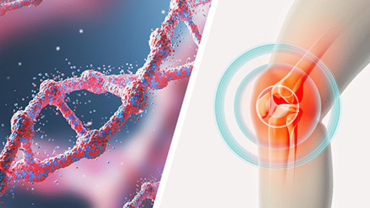 Glukozamin Takviyeleri için En İyi Öneriler
